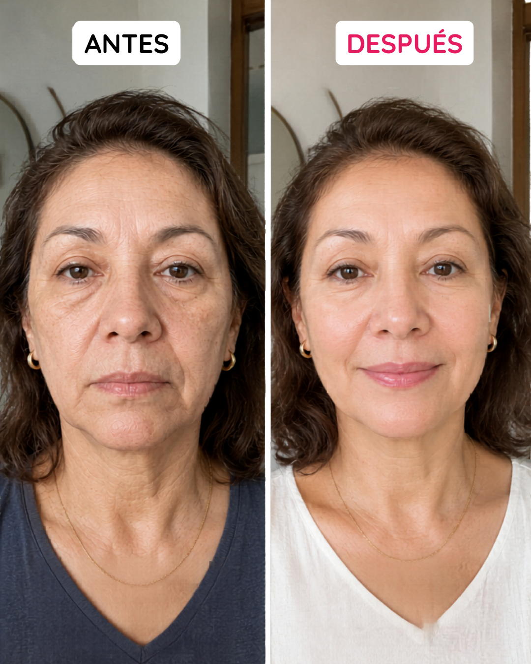 Antes y después 1