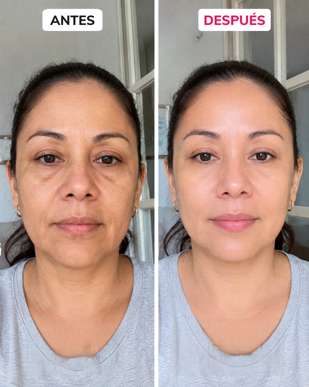 Antes y después 3